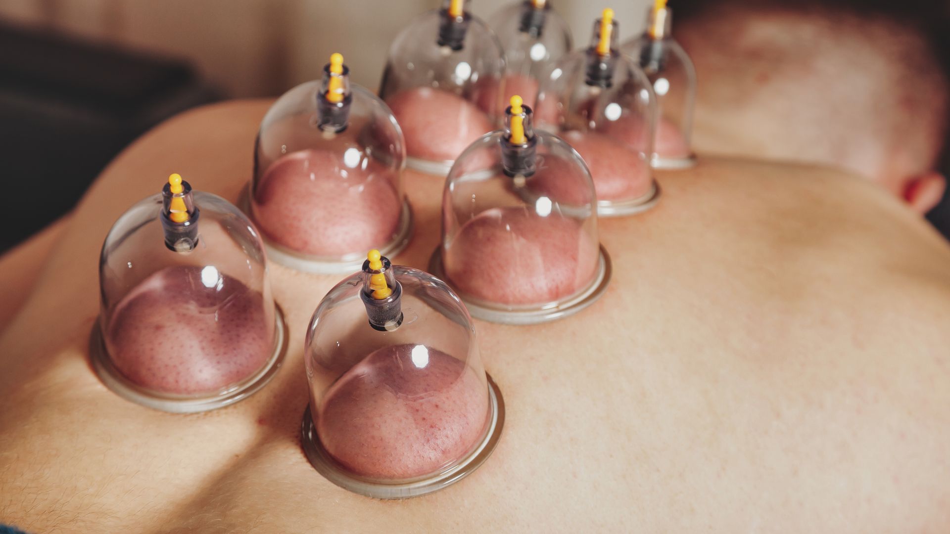 A man laying down with a bunch of small bottles on his back